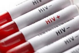 شناسایی۷۰۰ مبتلا به HIV در مشهد