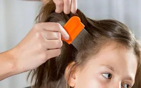 راهکار خلاصی کودک از شپش را بشناسید