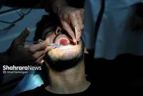 ۱۴ خدمت دندانپزشکی تحت پوشش بیمه سلامت است + جزئیات