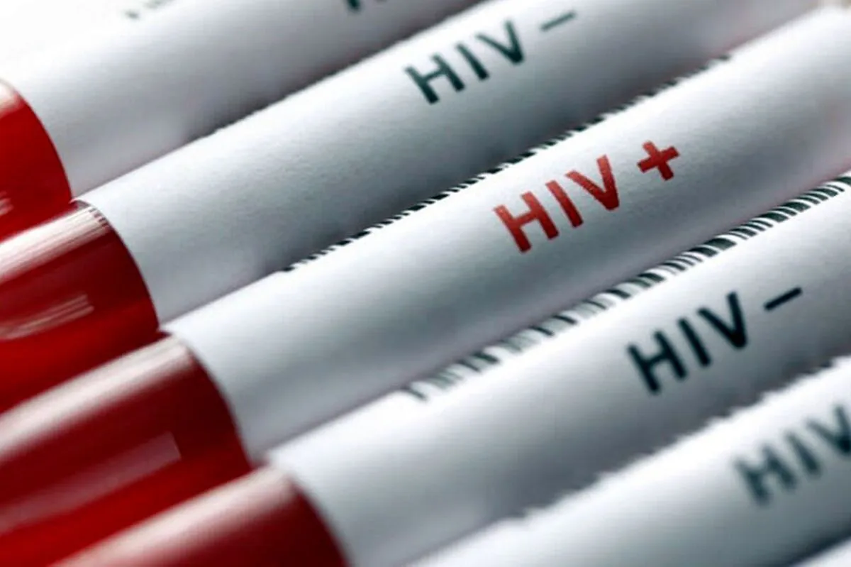 جنگ‌افزار جدید برای مقابله با HIV ساخته شد