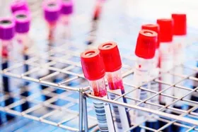 دانشمندان موفق به حذف ویروس HIV از سلول های آلوده شده&zwnj;اند
