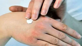 تدابیر ساده طب ایرانی برای مراقبت از پوست در شرایط بحرانی