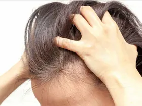 اینفوگرافی| بیماری&zwnj;های شایع مو و پوست سر