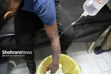 بخش سوختگی بیمارستان امام رضا(ع) در شب چهارشنبه سوری