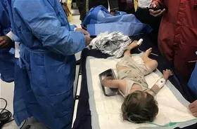 چرخ&zwnj;گوشت دست کودک دوساله را بلعید