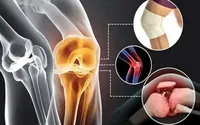 ابتلای حدود ۳۸ درصد از زنان ایرانی به پوکی استخوان
