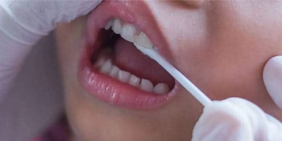 مراقبت از دندان‌های شیری و دائمی کودکان پس از ضربه