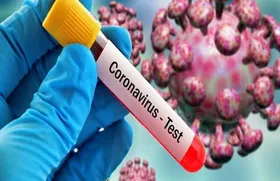 طرح سلول درمانی و ۲ واکسن برای کرونا بررسی می&zwnj;شود