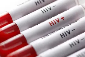 ابتلا به HIV ، میزان مرگ و میر کرونا را افزایش می دهد؟