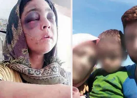 شکنجه&zwnj;های مژگان، زن رودباری توسط شوهر ۸۳ ساله اش