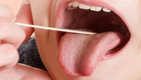 چرا دچار خشکی دهان می&zwnj;شویم؟