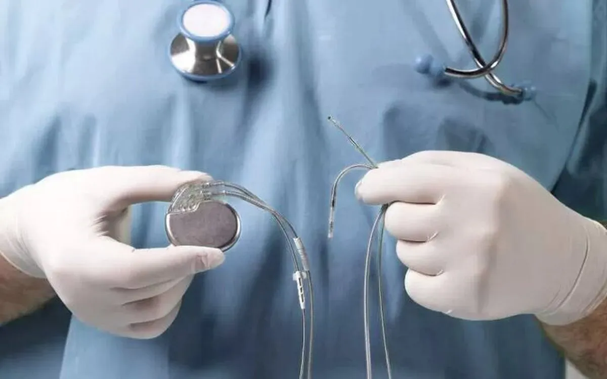 پایان صف انتظار باتری‌های قلبی و ICD | تأمین تجهیزات برای ۱۲ هزار بیمار