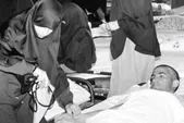 قصه یک عکس | روایت پرستاری که امنیت امروز دختران را با زخم‌های دیروز خرید