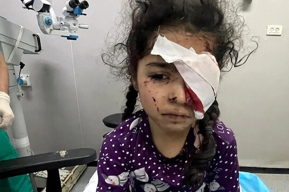 تاکنون ۱۵۰۰ فلسطینی در جنگ غزه بینایی خود را از دست داده‌اند