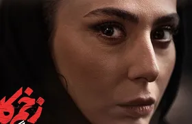 آغاز فیلمبرداری فصل دوم &laquo;زخم کاری&raquo;