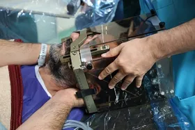نخستین عمل بیوپسی از ضایعات مغزی در مشهد انجام شد (۱۱ خرداد ۱۴۰۴)