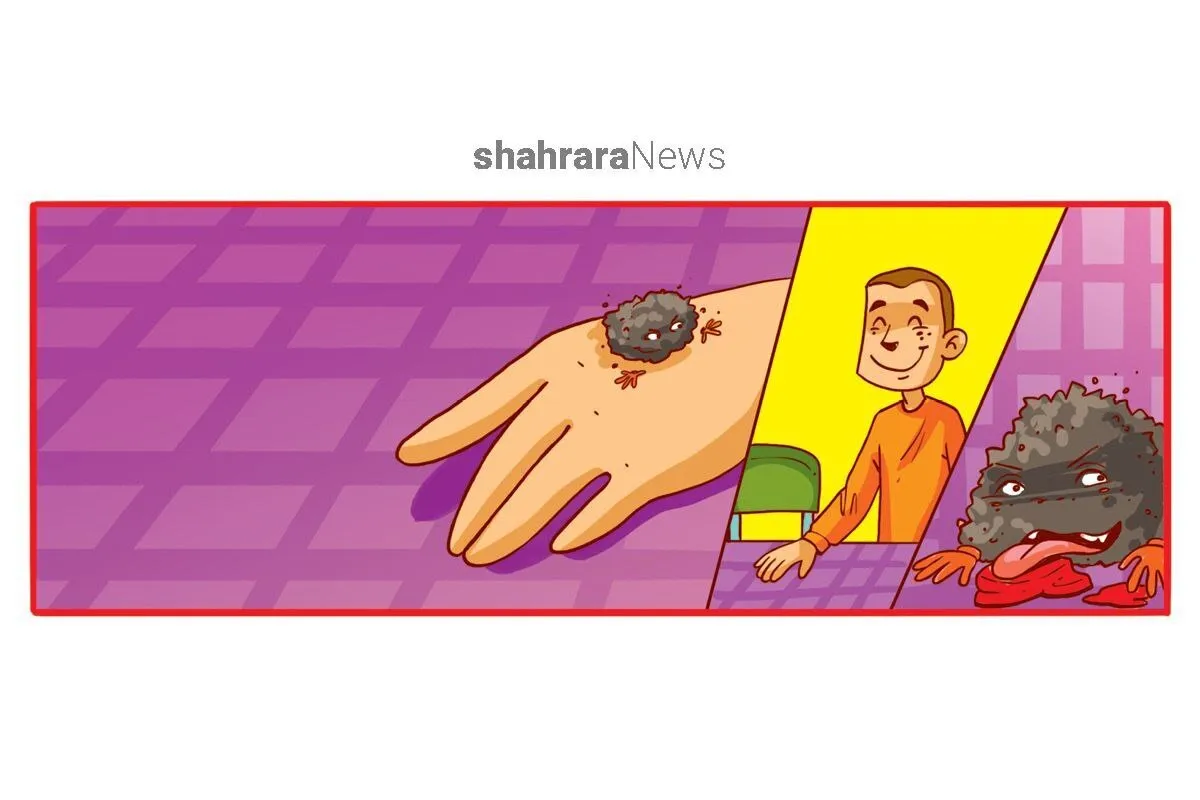 داستان تصویری کودک | میکروبی به نام چرکولک
