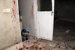 نخستین حادثه چهارشنبه‌سوری در مشهد با مجروحیت شدید جوان ترقه‌ساز+تصاویر