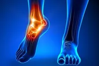 علت چرخش مچ پا چیست؟